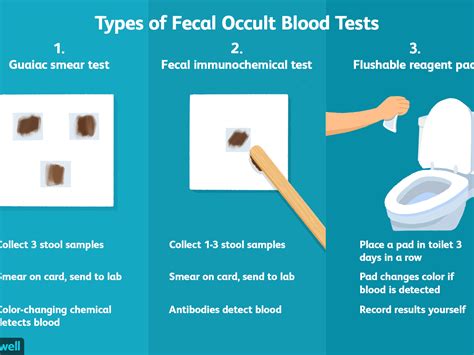 The Difference Between Stool Occult Blood Screening and Other Colon Cancer Tests